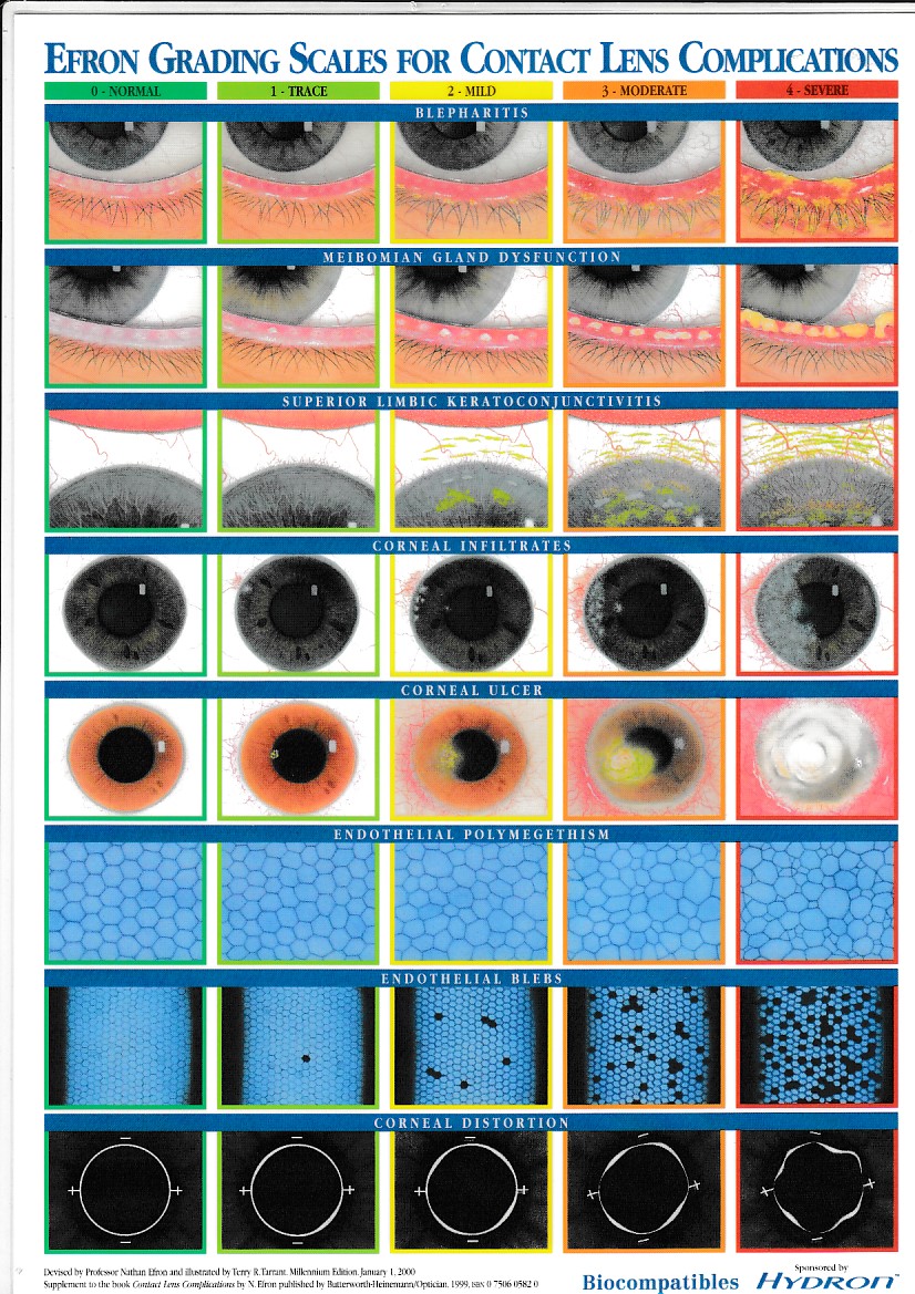 Archive Efron Grading Scales For Contact Lens Complications Archive Efron Grading Scales For Contact Lens Complications